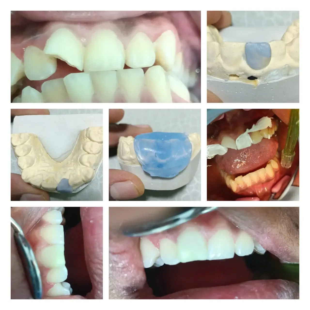 Dental Image 1